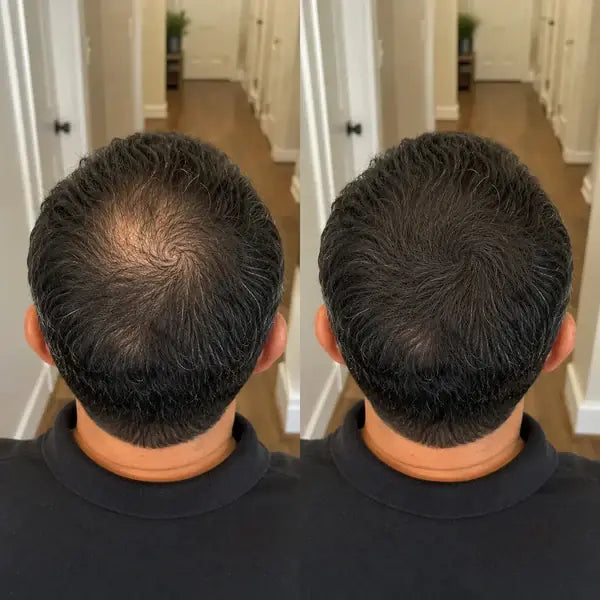 VORO Hair Building Fibers — 03
