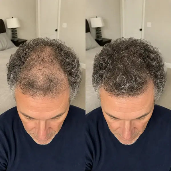 VORO Hair Building Fibers — 04